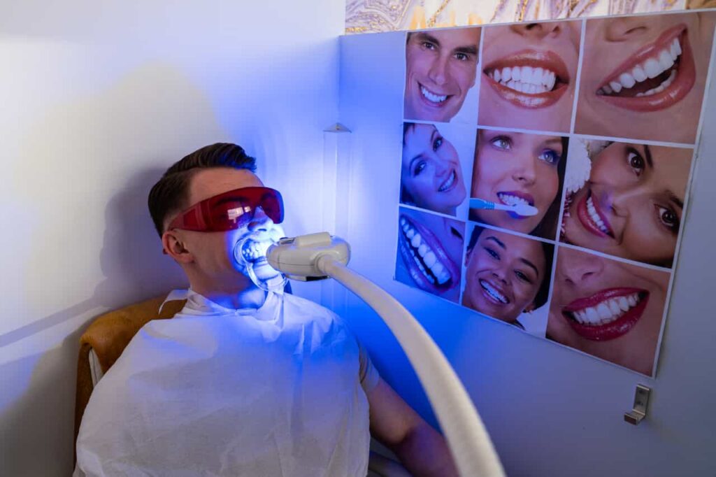 tanden bleken art beauty clinique rotterdam
